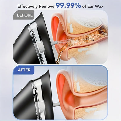 Auric™ - Gentle Water Irrigation for Home Use